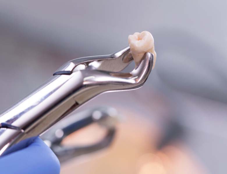 千葉市中央区の歯医者、医療法人社団 秀幸会 千葉スマイル歯科&矯正歯科の口腔外科