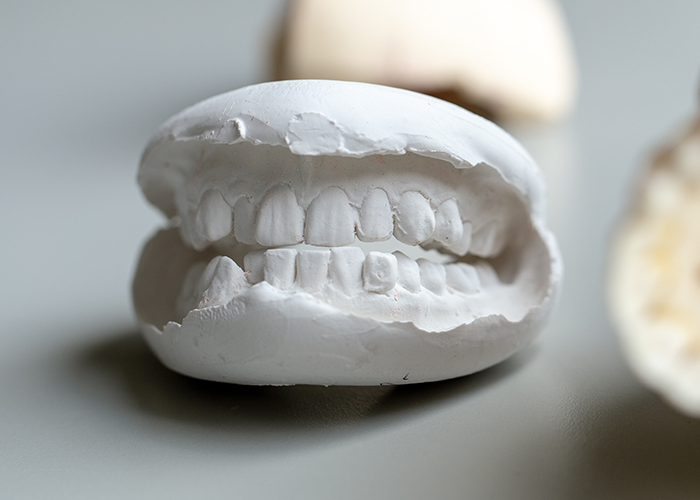 千葉市中央区の歯医者、医療法人社団 秀幸会 千葉スマイル歯科&矯正歯科の審美歯科治療