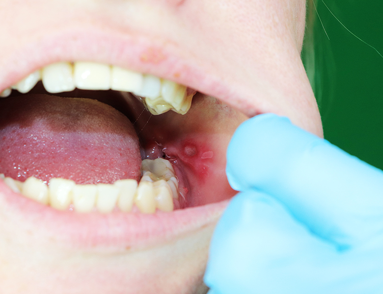 千葉市中央区の歯医者、医療法人社団 秀幸会 千葉スマイル歯科&矯正歯科の口腔外科