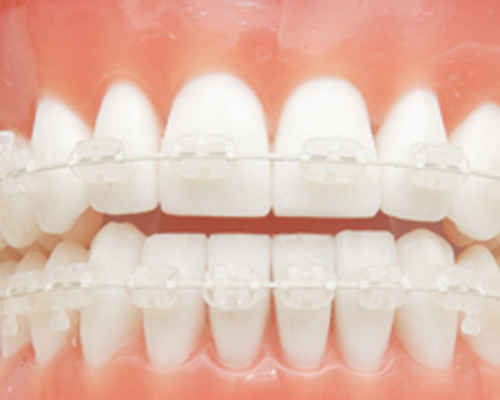 千葉市中央区の歯医者、医療法人社団 秀幸会 千葉スマイル歯科&矯正歯科の大人の矯正治療