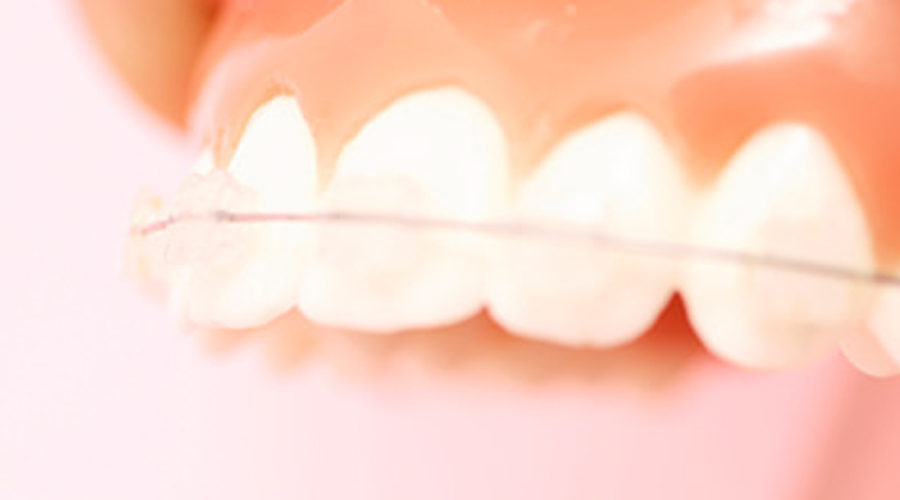 千葉市中央区の歯医者、医療法人社団 秀幸会 千葉スマイル歯科&矯正歯科の大人の矯正治療