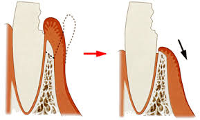千葉市中央区の歯医者、医療法人社団 秀幸会 千葉スマイル歯科&矯正歯科の口腔外科