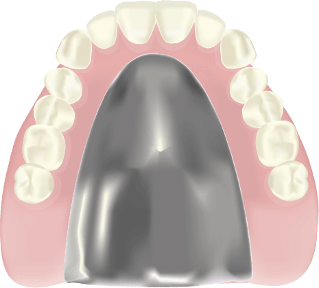 千葉市中央区の歯医者、医療法人社団 秀幸会 千葉スマイル歯科&矯正歯科の入れ歯(義歯)治療