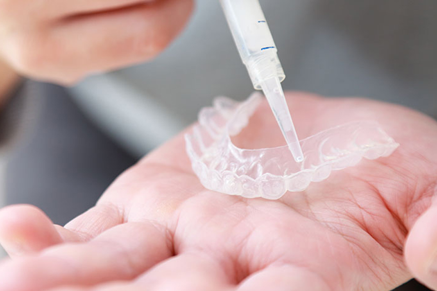 千葉市中央区の歯医者、医療法人社団 秀幸会 千葉スマイル歯科&矯正歯科のホワイトニング