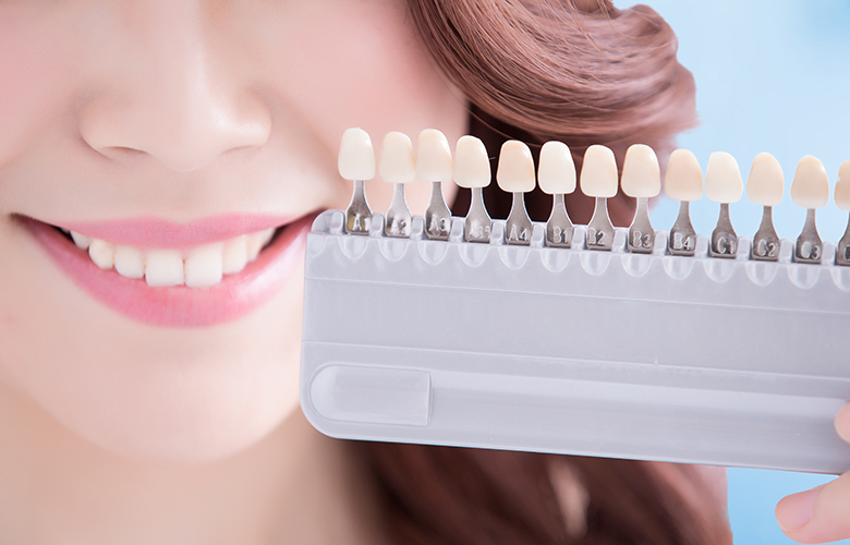 千葉市中央区の歯医者、医療法人社団 秀幸会 千葉スマイル歯科&矯正歯科のホワイトニング