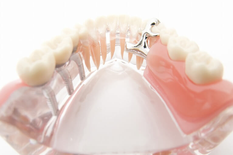 千葉市中央区の歯医者、医療法人社団 秀幸会 千葉スマイル歯科&矯正歯科の予防歯科