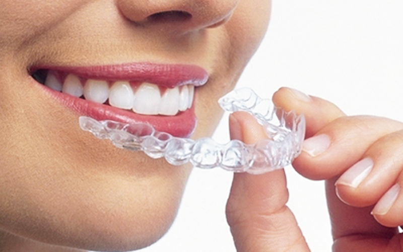 千葉市中央区の歯医者、千葉スマイル歯科&矯正歯科で矯正治療