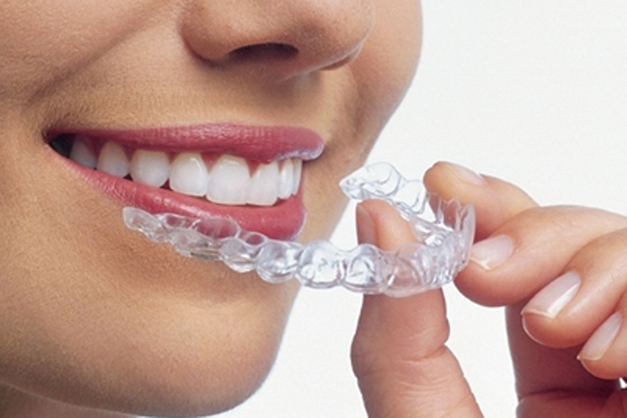 千葉市中央区の歯医者、医療法人社団 秀幸会 千葉スマイル歯科&矯正歯科の大人の矯正治療