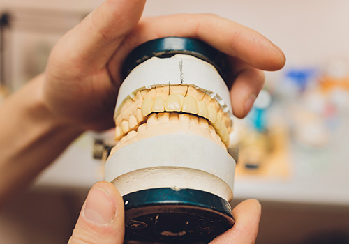 千葉市中央区の歯医者、医療法人社団 秀幸会 千葉スマイル歯科&矯正歯科の親知らずの抜歯