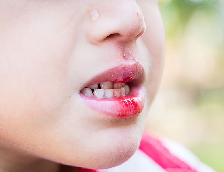 千葉市中央区の歯医者、医療法人社団 秀幸会 千葉スマイル歯科&矯正歯科の口腔外科