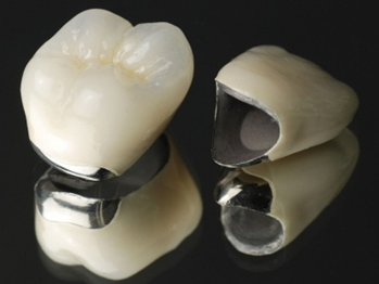 千葉市中央区の歯医者、医療法人社団 秀幸会 千葉スマイル歯科&矯正歯科の審美歯科治療