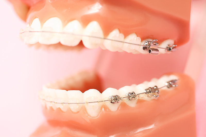 千葉市中央区の歯医者、医療法人社団 秀幸会 千葉スマイル歯科&矯正歯科の親知らずの抜歯