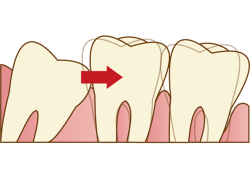 千葉市中央区の歯医者、医療法人社団 秀幸会 千葉スマイル歯科&矯正歯科の親知らずの抜歯