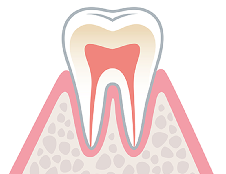 千葉市中央区の歯医者、医療法人社団 秀幸会 千葉スマイル歯科&矯正歯科の歯周病治療