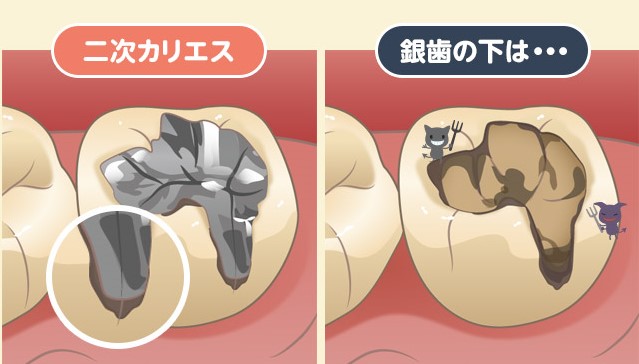 千葉市中央区の歯医者、医療法人社団 秀幸会 千葉スマイル歯科&矯正歯科の予防歯科