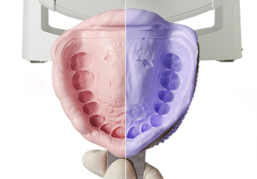 千葉市中央区の歯医者、医療法人社団 秀幸会 千葉スマイル歯科&矯正歯科の審美歯科治療