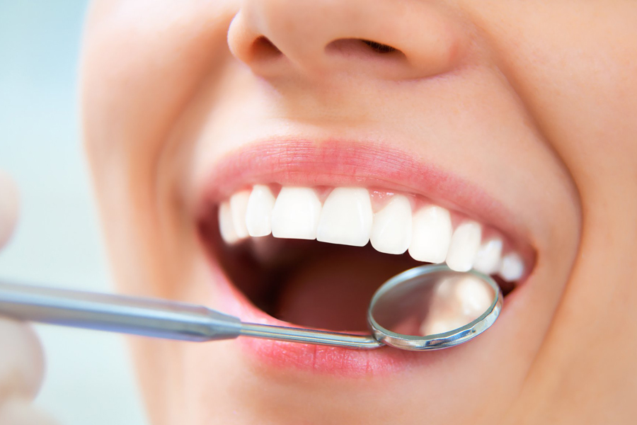 千葉市中央区の歯医者、医療法人社団 秀幸会 千葉スマイル歯科&矯正歯科の歯周病治療